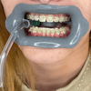 Oralis-cinza-boca