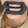 Oralis-preto-boca